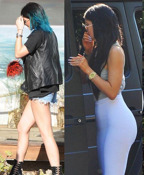 Kylie jenner fessier avant apres